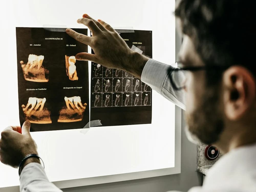 Escáner intraoral 3D en Odontología Integral General
